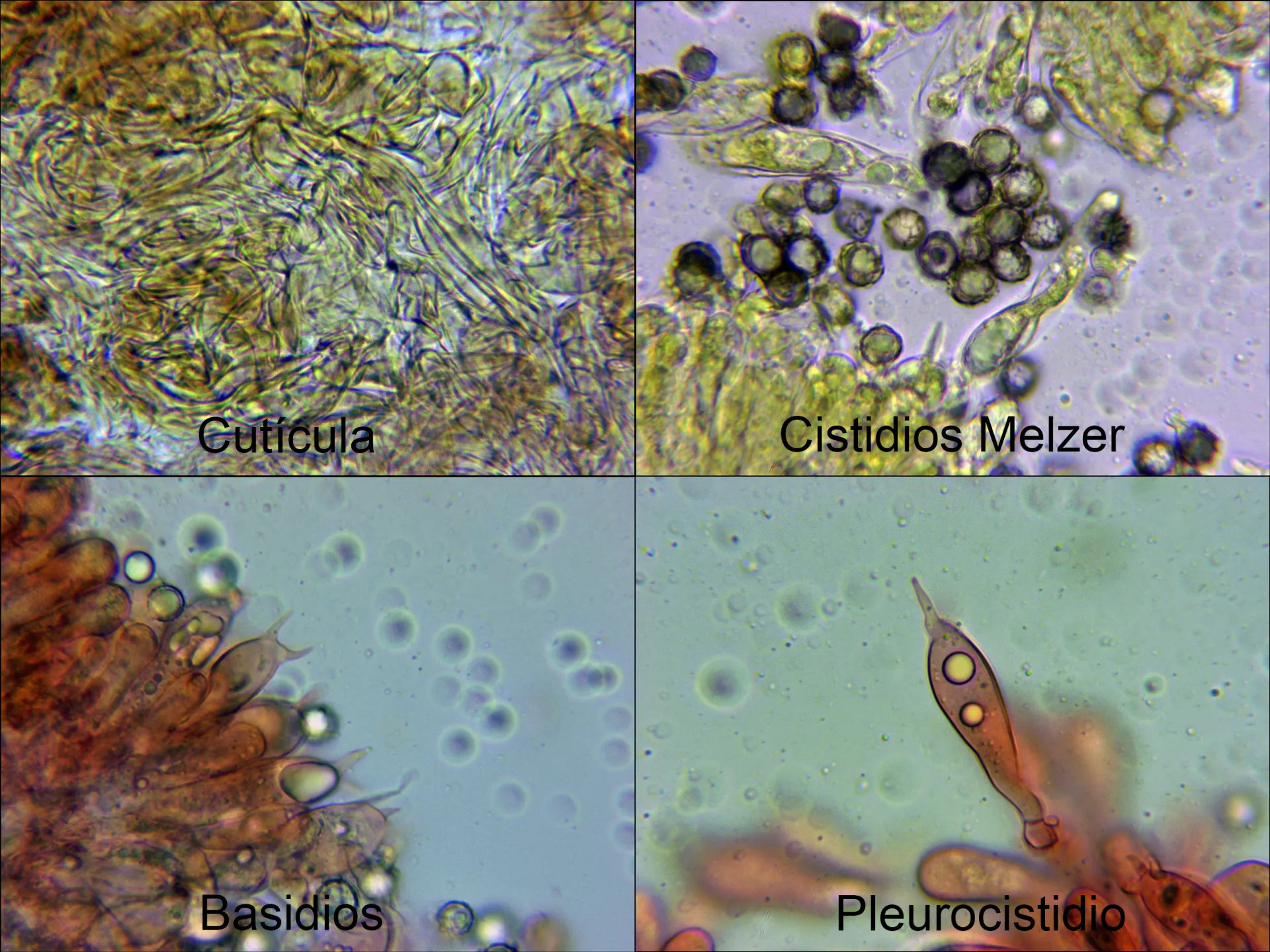 Microscopía de 10 - Lactarius aurantiacus micro
